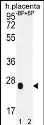 OR2J3 Antibody in Western Blot (WB)
