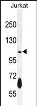 PDE3B Antibody in Western Blot (WB)