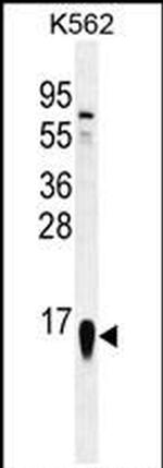 RPS19 Antibody in Western Blot (WB)