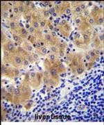 GGH Antibody in Immunohistochemistry (IHC)