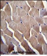 VILL Antibody in Immunohistochemistry (IHC)