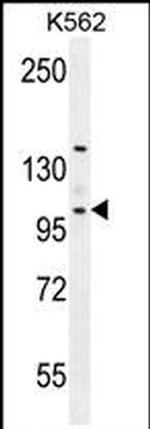 VILL Antibody in Western Blot (WB)