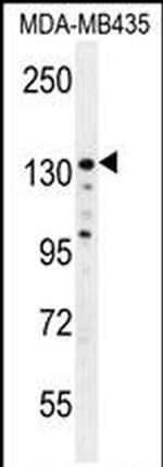 ZEB2 Antibody in Western Blot (WB)