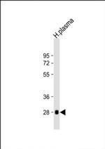 Complement Factor D Antibody in Western Blot (WB)