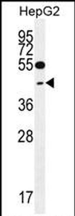 TXNL2 Antibody in Western Blot (WB)