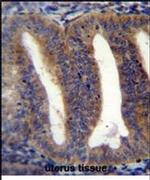 Rbpms2 Antibody in Immunohistochemistry (IHC)
