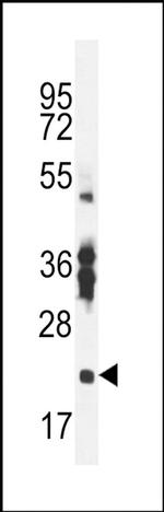 Rbpms2 Antibody in Western Blot (WB)