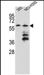 PRAMEF12 Antibody in Western Blot (WB)