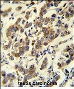 MBD3L3 Antibody in Immunohistochemistry (IHC)
