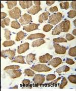 KBTBD13 Antibody in Immunohistochemistry (IHC)
