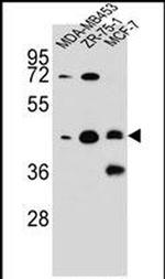 KBTBD13 Antibody in Western Blot (WB)