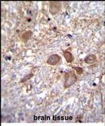 SPECC1L Antibody in Immunohistochemistry (IHC)