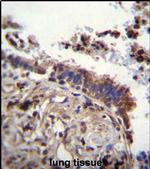 TTBK2 Antibody in Immunohistochemistry (IHC)