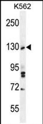 TTBK2 Antibody in Western Blot (WB)