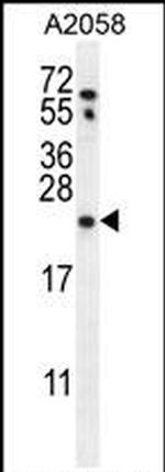 RAB10 Antibody in Western Blot (WB)