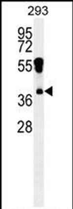 RHOXF2 Antibody in Western Blot (WB)