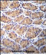 TOR2A Antibody in Immunohistochemistry (IHC)