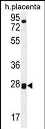 TOR2A Antibody in Western Blot (WB)