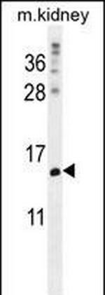 Morn5 Antibody in Western Blot (WB)