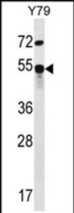 ZFP14 Antibody in Western Blot (WB)