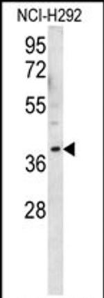 OR2AK2 Antibody in Western Blot (WB)