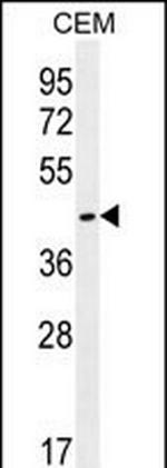 OR8H2/OR8H3 Antibody in Western Blot (WB)