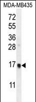 UNQ6493/PRO21345 Polyclonal Antibody