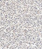 ASM Polyclonal Antibody