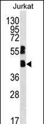 MAFB Polyclonal Antibody