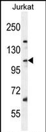 SNX25 Antibody in Western Blot (WB)