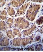TMPRSS15 Polyclonal Antibody