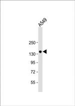TMPRSS15 Antibody in Western Blot (WB)