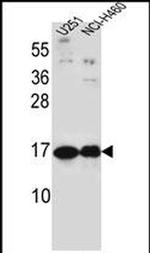 Pleiotrophin Antibody in Western Blot (WB)