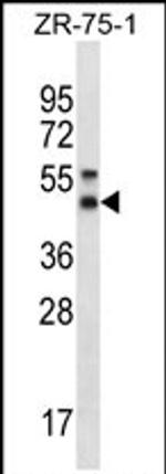 STX5 Antibody in Western Blot (WB)