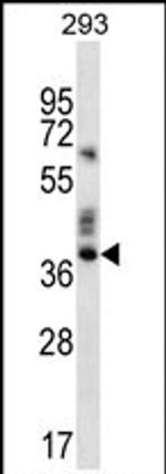 OR9K2 Antibody in Western Blot (WB)