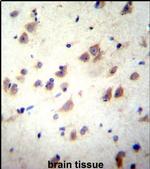 NMDAR3B Antibody in Immunohistochemistry (IHC)
