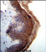 IL1F5 Antibody in Immunohistochemistry (IHC)