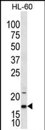 IL1F5 Antibody in Western Blot (WB)