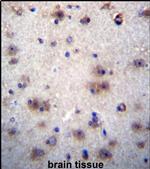 EVPLL Antibody in Immunohistochemistry (IHC)