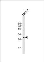 EVPLL Antibody in Western Blot (WB)
