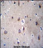 PCDHB14 Antibody in Immunohistochemistry (IHC)