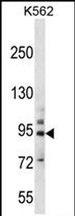 PCDHB14 Antibody in Western Blot (WB)