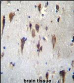 PCDH7 Antibody in Immunohistochemistry (IHC)