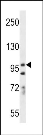 PCDH7 Antibody in Western Blot (WB)