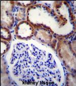 MAP3K15 Antibody in Immunohistochemistry (IHC)