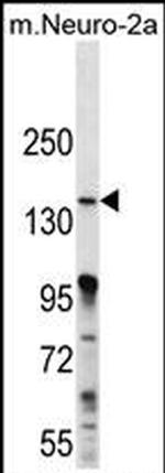 MAP3K15 Antibody in Western Blot (WB)