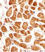 PCCA Antibody in Immunohistochemistry (IHC)