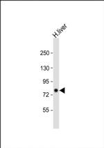 PCCA Antibody in Western Blot (WB)