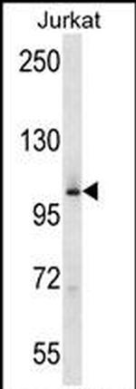 MAP4K2 Antibody in Western Blot (WB)