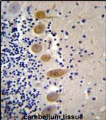 MST1 Antibody in Immunohistochemistry (IHC)